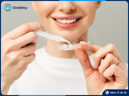 tẩy trắng răng tại nhà