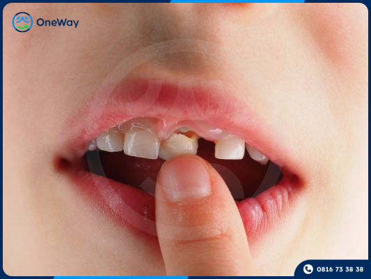 nha khoa dự phòng