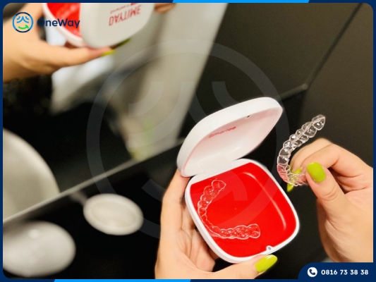 khay niềng smartee