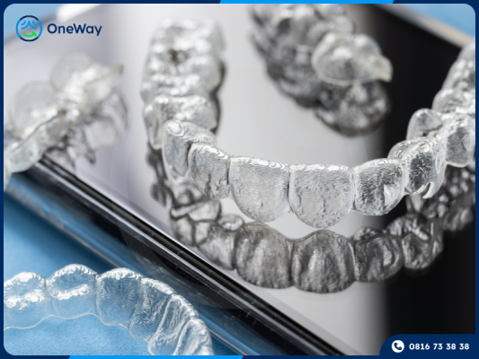 niềng răng không mắc cài