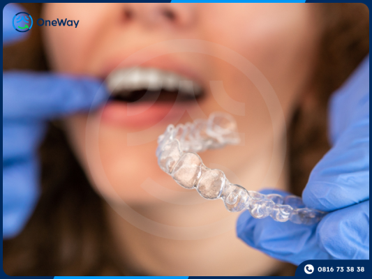 niềng răng khay trong