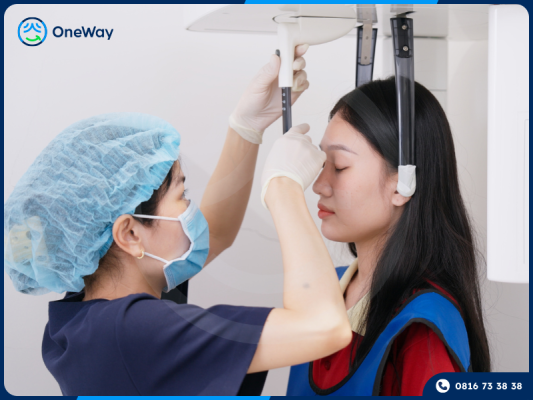 chụp phim CT ConeBeam