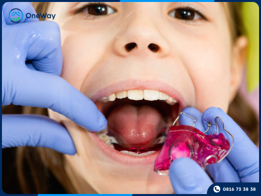 khí cụ tháo lắp