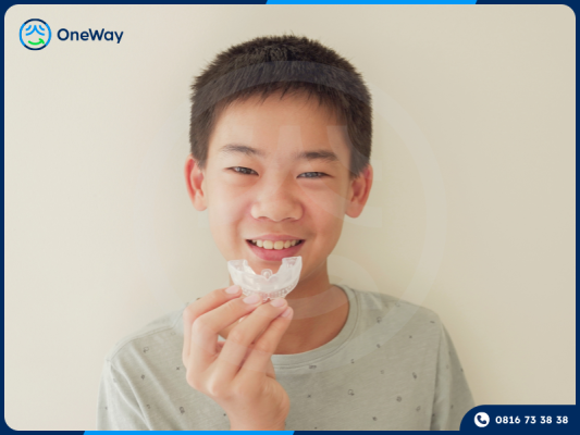 niềng răng cho trẻ em