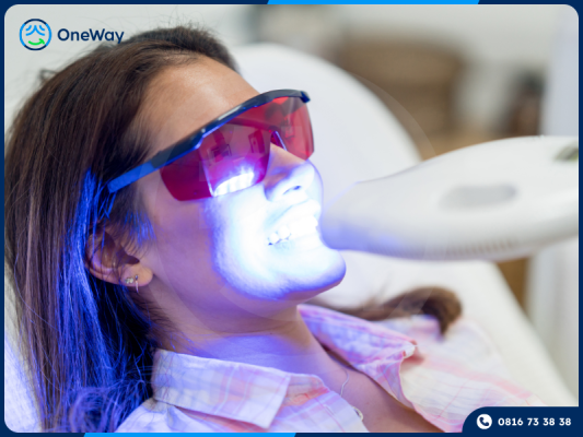 giảm ê buốt sau khi tẩy trắng răng