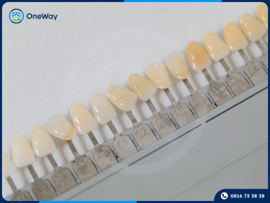 tẩy trắng răng sứ